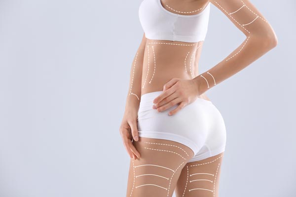 Top Benefits Of Availing Non-Surgical Body Sculpting Treatment